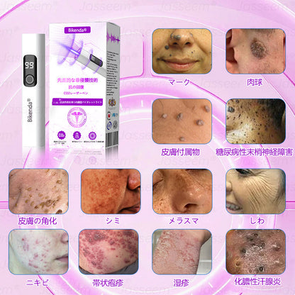 Bikenda® 高性能CO₂レーザーペン 🛫（痛みなし・面倒なしで、イボ・ほくろ・シミ・小さな肌のふくらみをやさしく除去！）お肌のケアにおすすめの非侵襲的アイテムだよ！