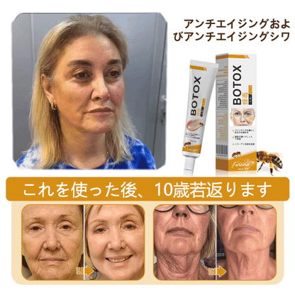 💎🐝 Furzero™ ボトックス＆ビーベノム しわ取りリフトアップクリーム✨🔥 最終日限定プロモーション – 70%OFF ✨🔥