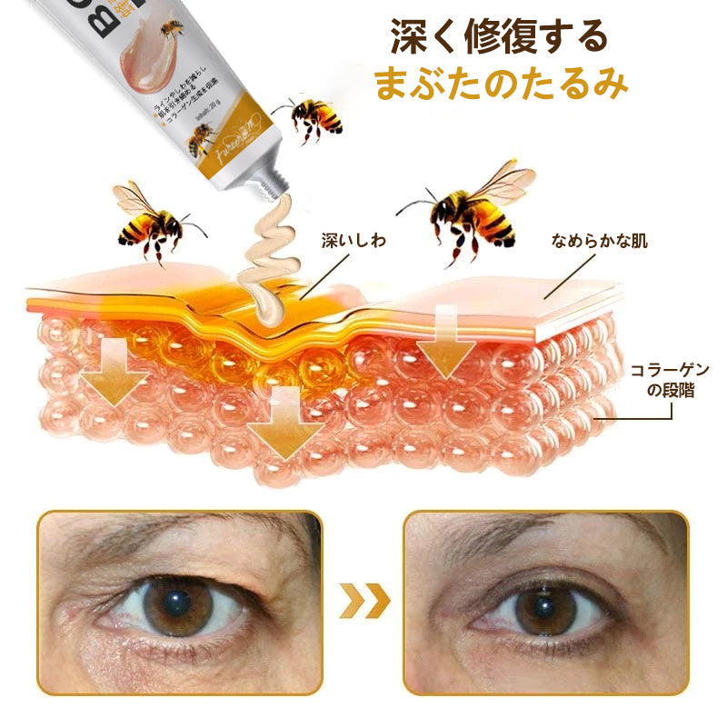 💎🐝 Furzero™ ボトックス＆ビーベノム しわ取りリフトアップクリーム✨🔥 最終日限定プロモーション – 70%OFF ✨🔥