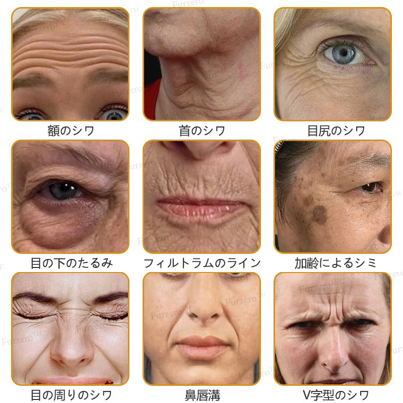 💎🐝 Furzero™ ボトックス＆ビーベノム しわ取りリフトアップクリーム✨🔥 最終日限定プロモーション – 70%OFF ✨🔥