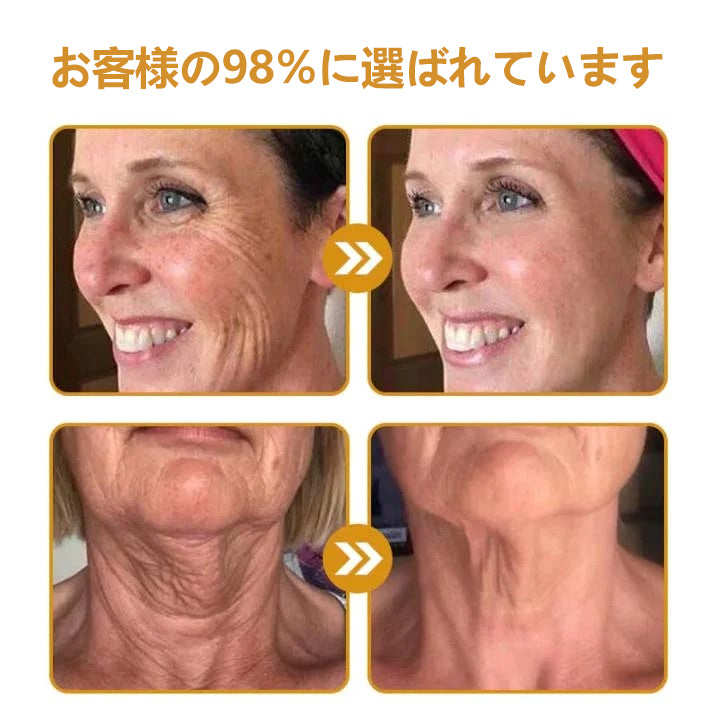 💎🐝 Furzero™ ボトックス＆ビーベノム しわ取りリフトアップクリーム✨🔥 最終日限定プロモーション – 70%OFF ✨🔥