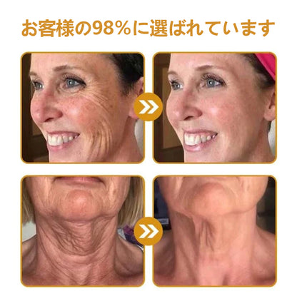 💎🐝 Furzero™ ボトックス＆ビーベノム しわ取りリフトアップクリーム✨🔥 最終日限定プロモーション – 70%OFF ✨🔥