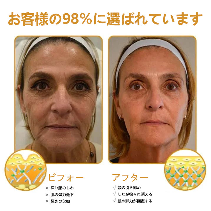 💎🐝 Furzero™ ボトックス＆ビーベノム しわ取りリフトアップクリーム✨🔥 最終日限定プロモーション – 70%OFF ✨🔥