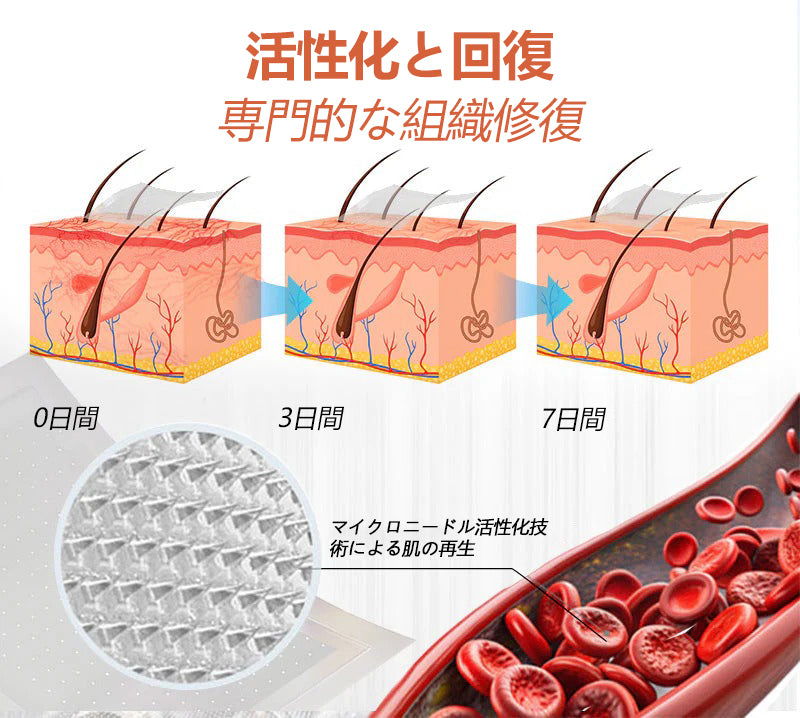 ☘️【厚生労働省認可・GMP準拠】Zvoevo® Vein Ease マイクロニードルケアパッチ（クモ状静脈・静脈瘤・むくみ・脚の疲れに）